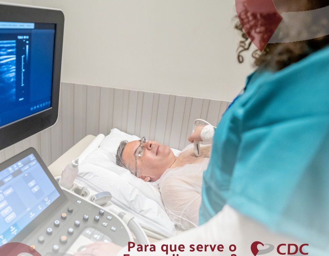 exame-ecocardiograma-cdc-centro-diagnostico-cardiograma-campo-grande-ms