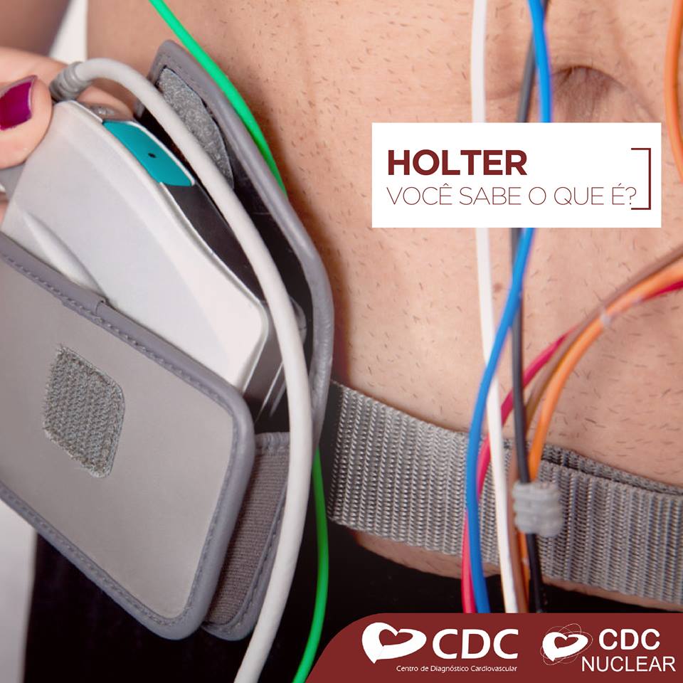 Holter - Clínica CDC Centro de Diagnóstico Cardiovascular