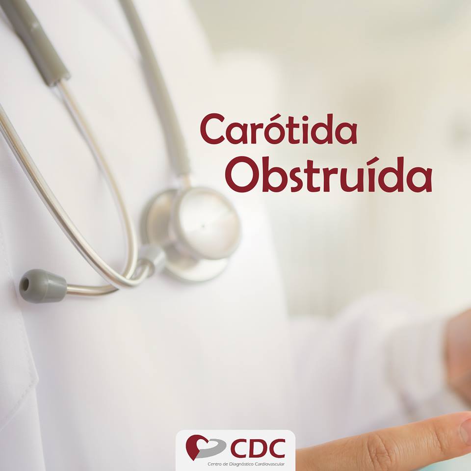 carótida-obstruída-clinica-cdc-centro-diagnostico-cardiovascular