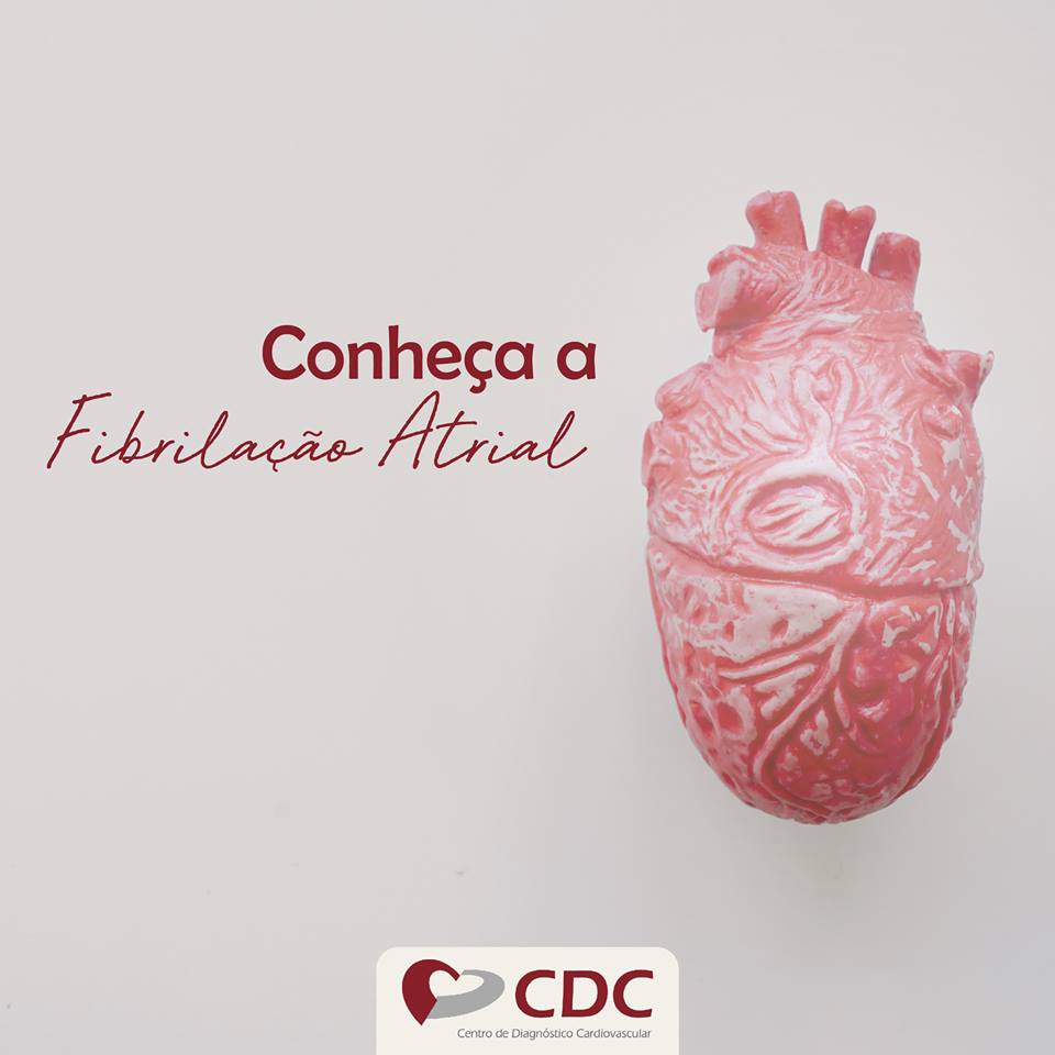 Fibrilação-arterial-clinica-cdc-centro-diagnostico-cardiovascular