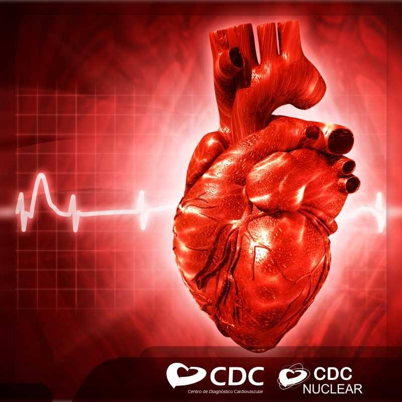 exames-clinica-cdc-cardiovascular-campo-grande-ms